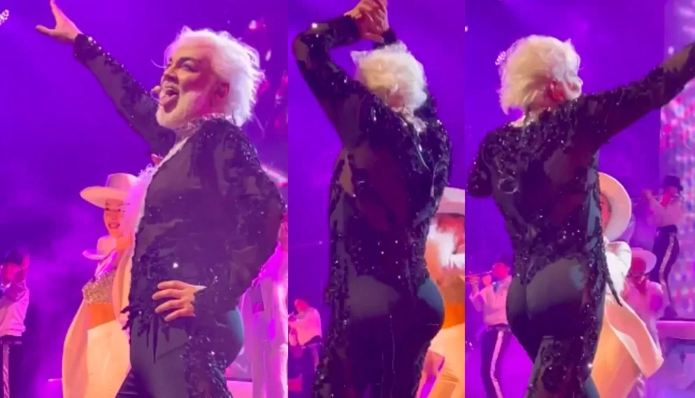 Хирург Алексанян: насколько я знаю артист Киркоров не делал коррекцию ягодиц