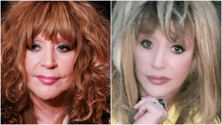 Косметолог объяснила, что резко помолодевшая Пугачева сделала со своим лицом