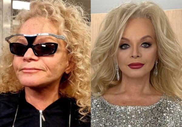 Пластический хирург Любченко похвалила певицу РФ Ларису Долину за качество кожи