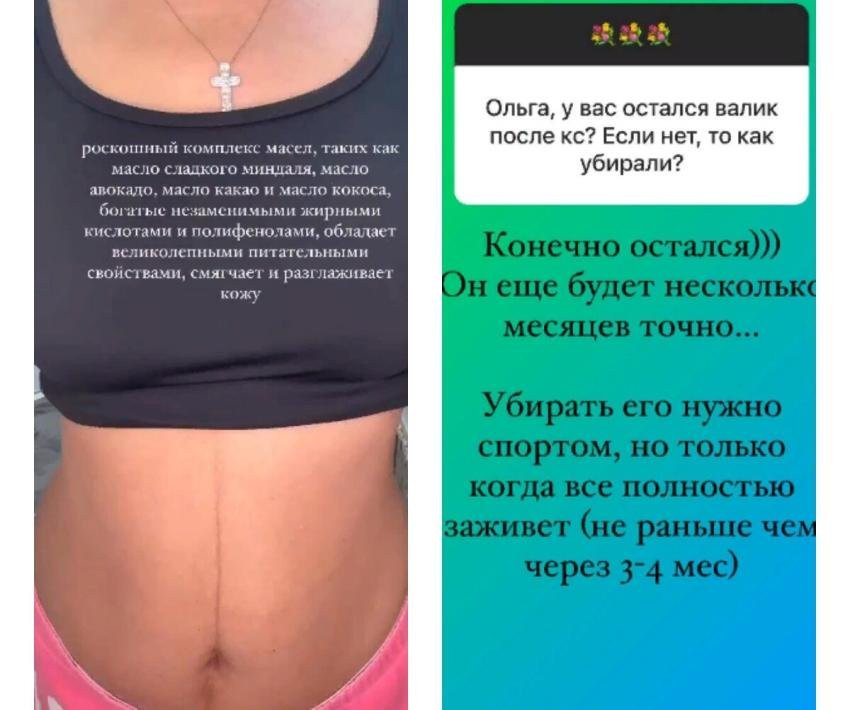 Телеведущая из России Ольга Орлова впервые продемонстрировала свой живот после родов