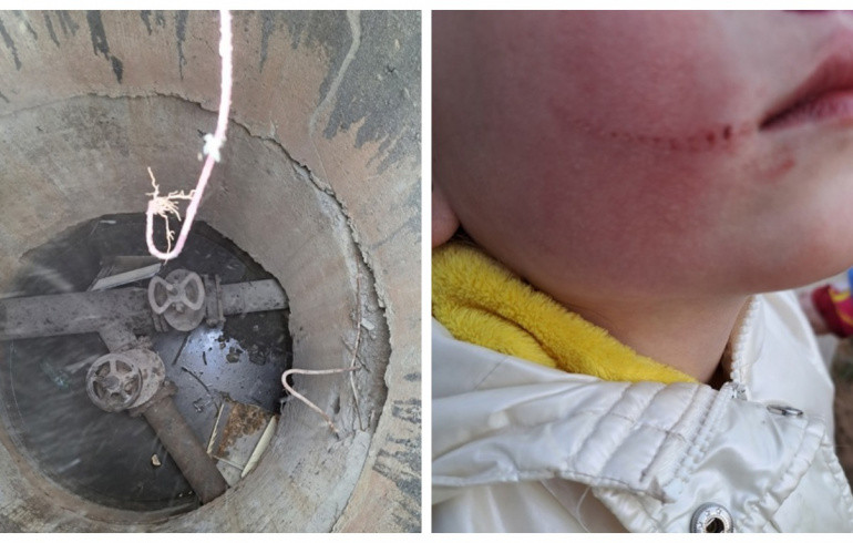 В Челябинской области 5-летняя девочка упала на арматуру в канализационном колодце