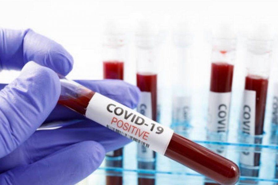 «RG.RU»: Минздрав и Роспотребнадзор РФ разъяснили заявление ВОЗ об окончании пандемии коронавируса COVID-19