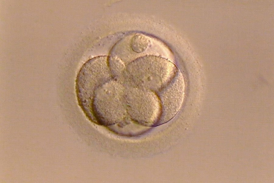 В Великобритании родились первые дети от трех родителей