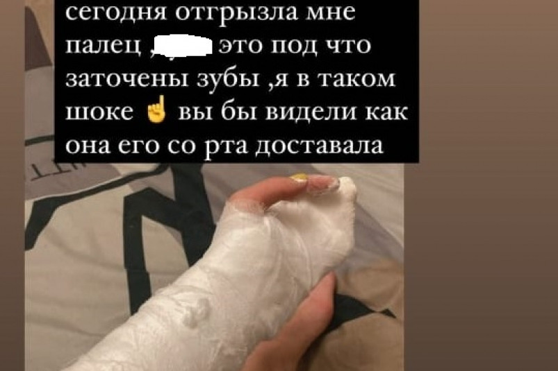 Жительница Приморья в драке откусила часть пальца оппонентке