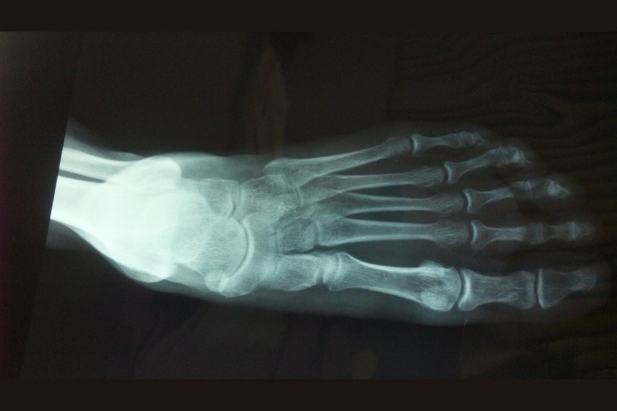 Японский ручной сканер терагерцового диапазона — это "рентген" без вредного излучения