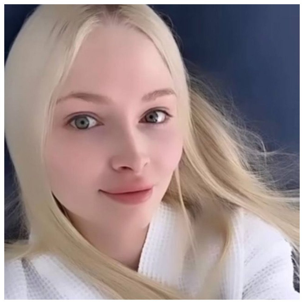 Алёна Шишкова решилась на пластическую операцию