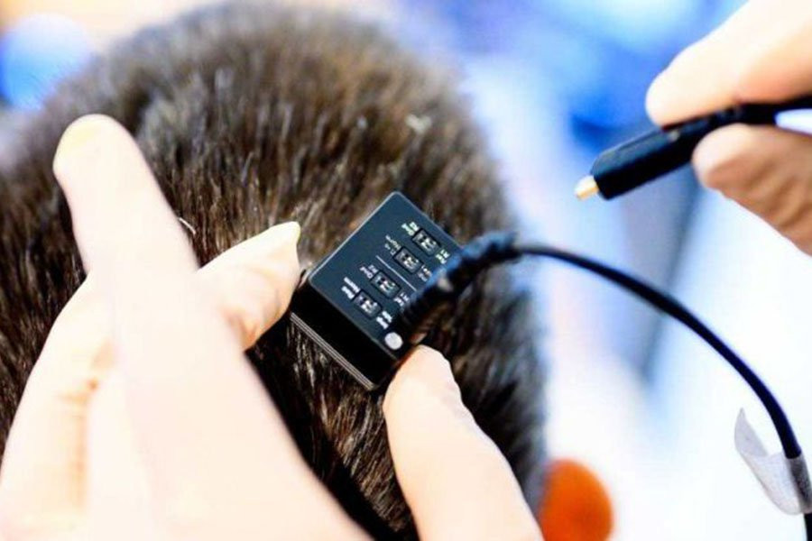 Nature: удивительный мозговой имплантат дает голос людям, которые годами не могли говорить