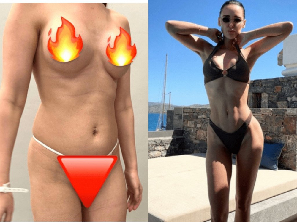 Выяснилось, какие пластические операции перенесла жена хирурга Тимура Хайдарова