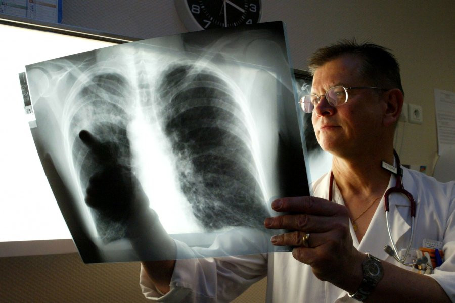 Доктор Мясников рассказал, какие симптомы указывают на болезнь легионеров