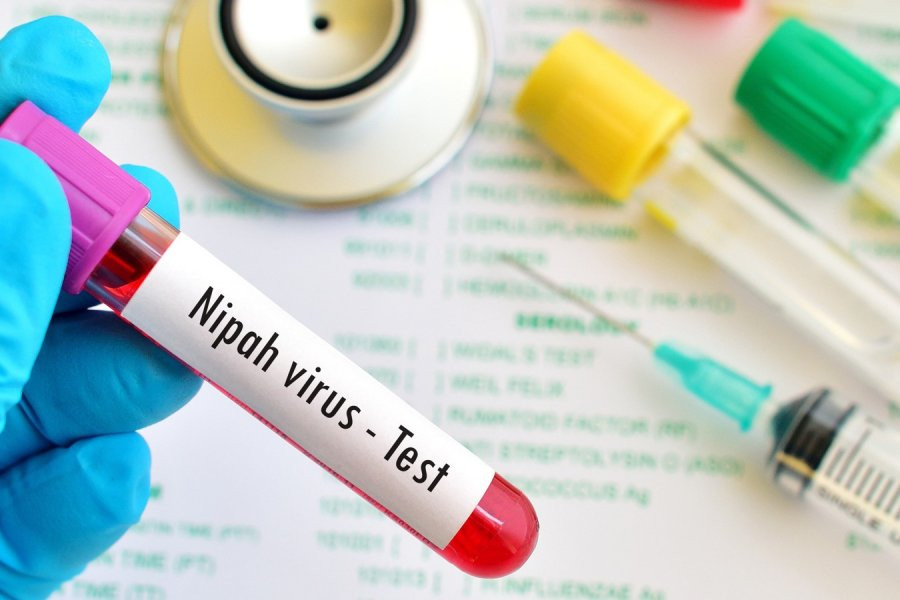 Доктор рассказала о риске заразиться вирусом Нипах