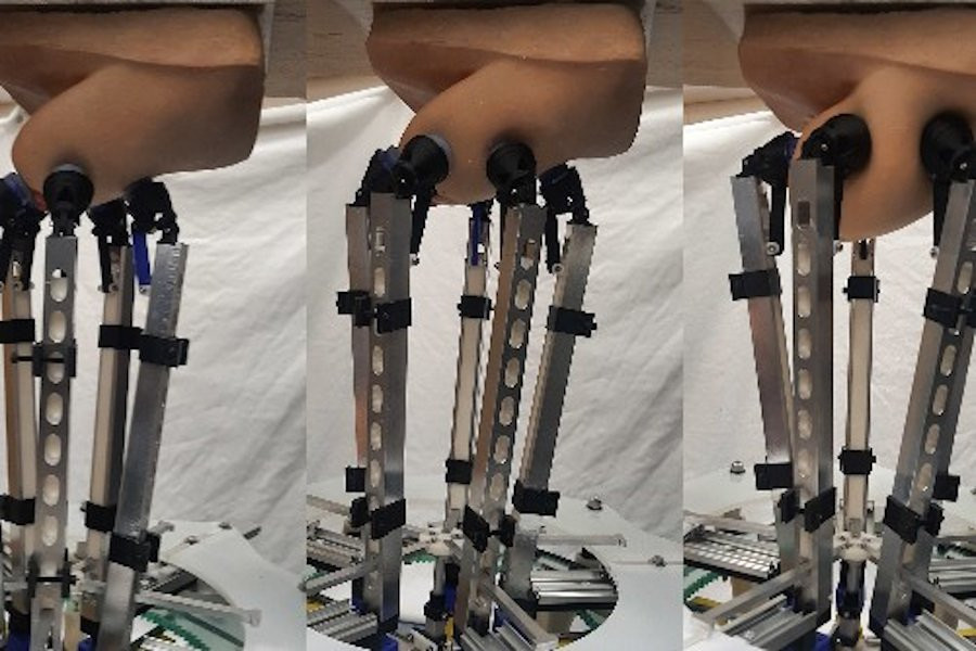 Манипулятор-маммолог щупает грудь женщин в поисках раковых уплотнений