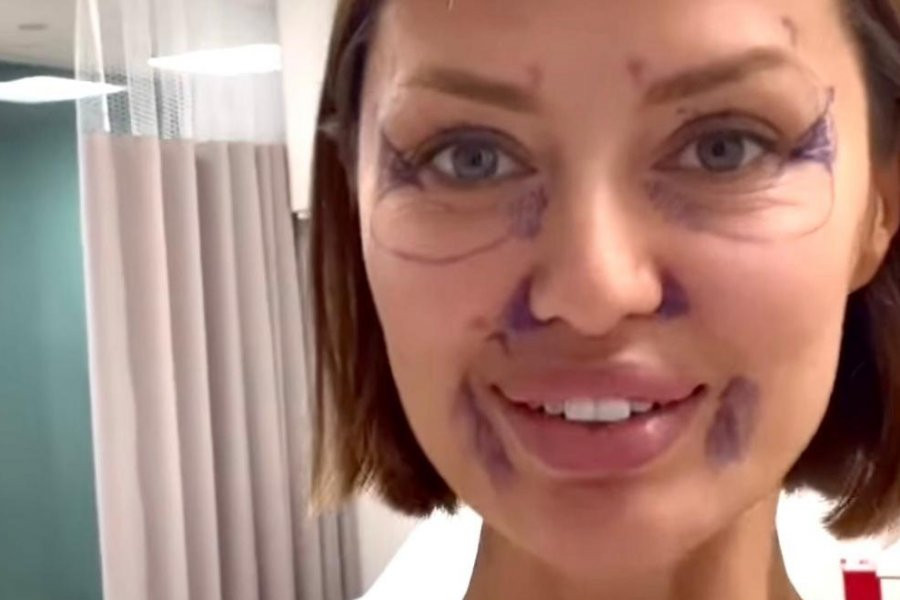 Виктория Боня бесплатно показала лицо после пластики