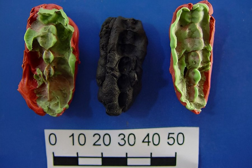 Скандинавские охотники-собиратели страдали от кариеса и заболеваний десен