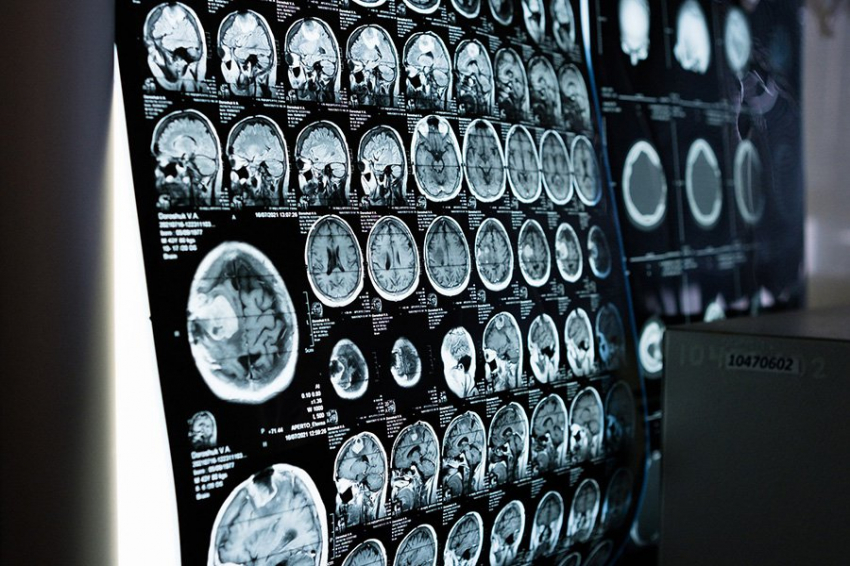 ИИ может определить пол человека по сканированию мозга с точностью до 90 процентов