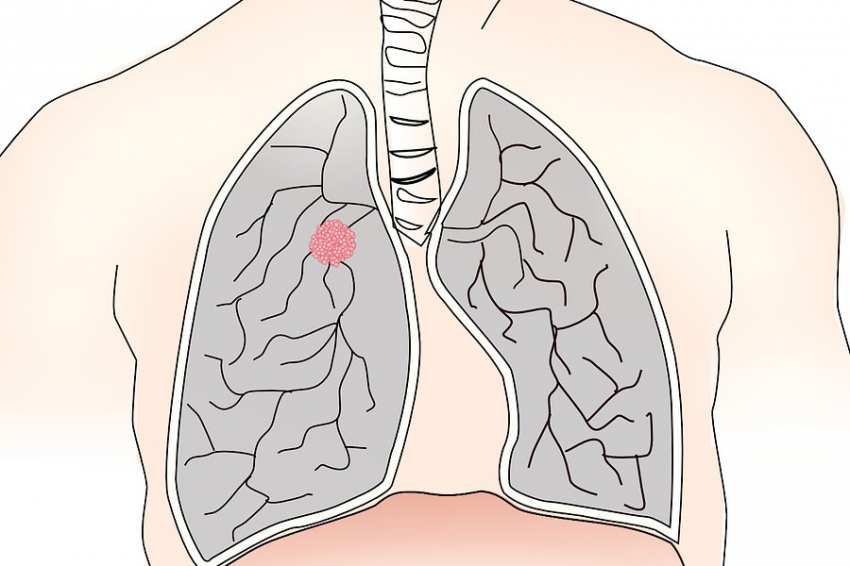 NIH: особая структура белка EGFR способствует устойчивости рака к терапии