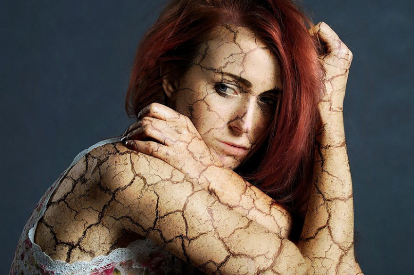 Установлено, что постковидная депрессия проявляется чаще у женщин, чем у мужчин