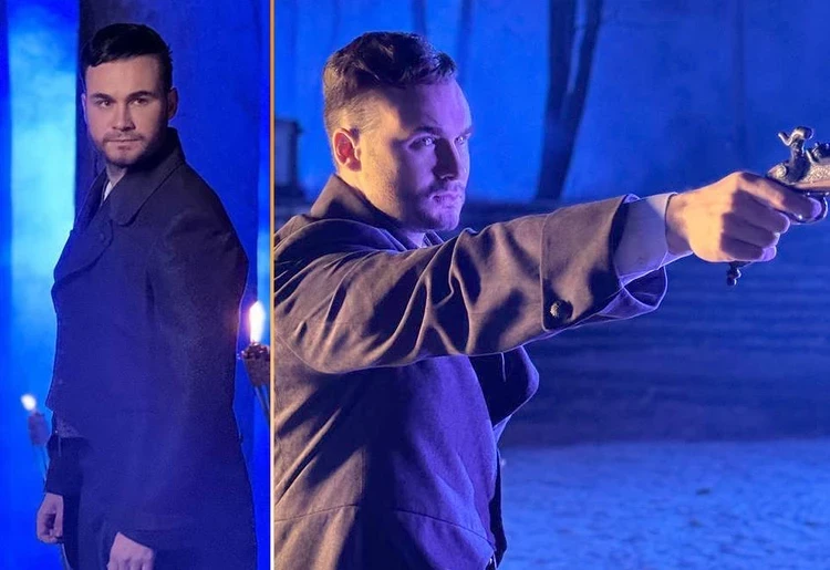 Николай Соболев откровенно рассказал о пересадке волос: «В 31 год я начал стремительно лысеть»